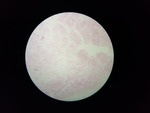MISSING THUMBNAIL